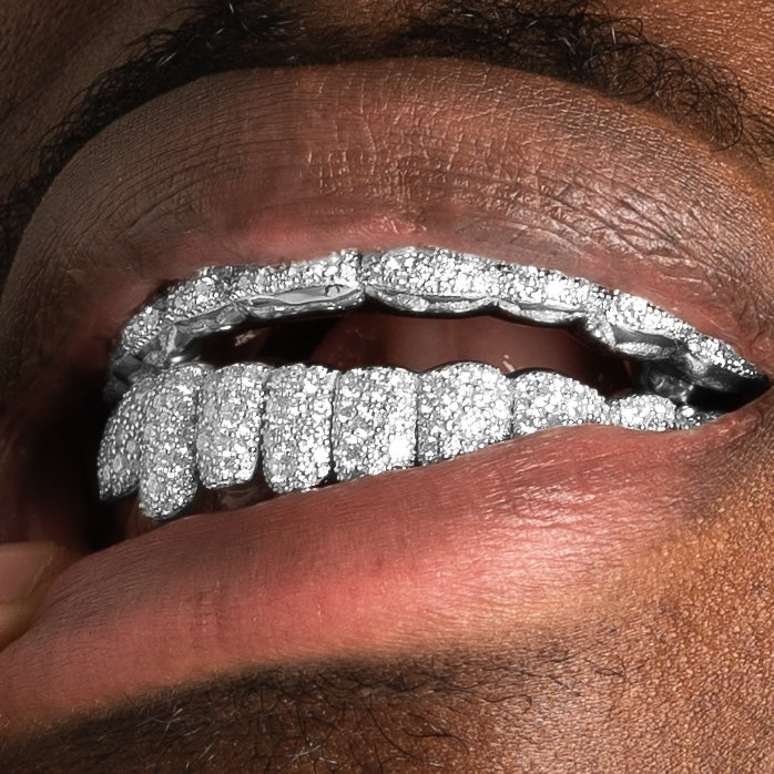 Mosaic Moissanite Grillz - Image 4